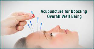 The Benefits of Acupuncture for Health and Wellness
